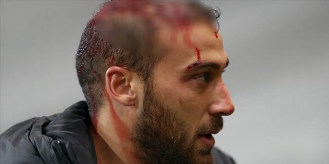 Cenk Tosun'un korkutan sakatlığı!