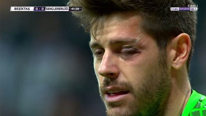 Beşiktaş'ta Fabri şoku!